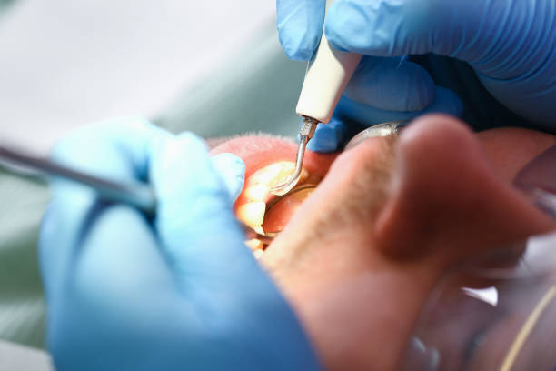Best Weekend Emergency Dentist in Brown Station, MD