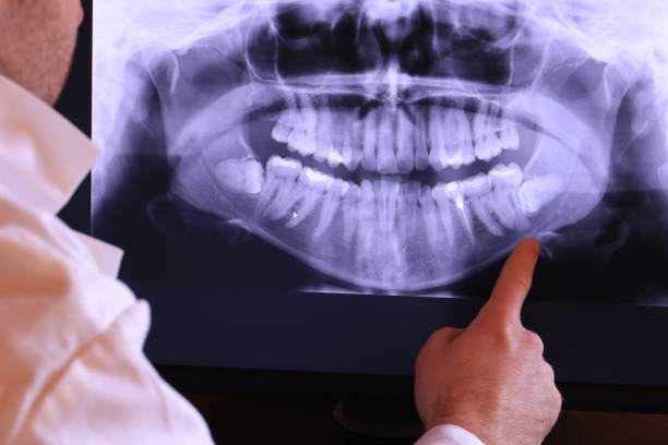 Best Broken or Cracked Tooth Emergency Dentist in Brown Station, MD